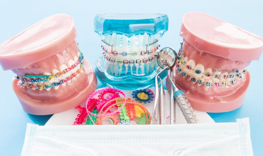 Aparate dentare: ghid complet al tratamentelor moderne